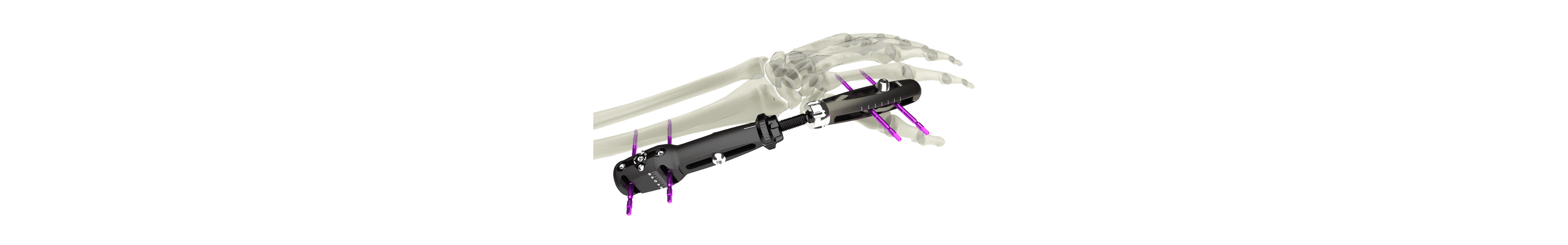 UniX® Wrist