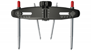 MicroLift® — system overview 1