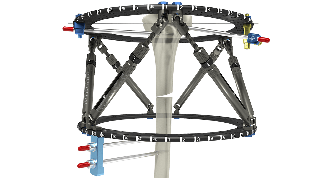 Smart Fixator frame assembly